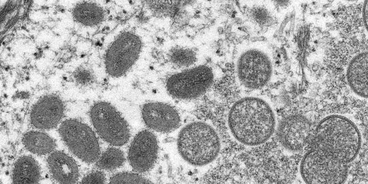 WHO ruft vorerst keinen internationalen Gesundheitsnotstand wegen Affenpocken aus