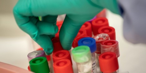 bb5253b37882671b9a6c990b3e480efd10a85caf